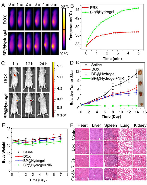 PNAS：智能黑磷水凝胶有望实现癌症精准治疗- X-MOL资讯